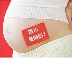 东方怀孕期间可以做亲子鉴定吗 